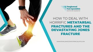 How to Deal with Horrific Metatarsal Fractures and the Devastating Jones Fracture [upl. by Peednas858]