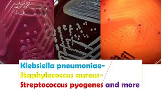 KlebsiellaStaphylococcus Betahaemolytic Streptococci Enterococcus Serratia Micrococcus [upl. by Yelsha867]