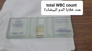 فحص خلايا الدم البيضاء  Total WBC count [upl. by Frederique]