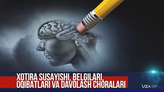 Xotira susayishi belgilari oqibatlari va davolash choralari [upl. by Donnenfeld]