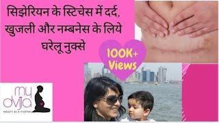 CESAREAN STITCHES PAIN home care सिझेरियन के स्टिचेस में दर्द खुजली और नम्बनेस के घरेलू नुक्से [upl. by Berna297]