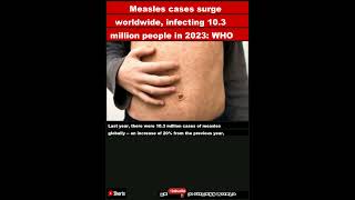 Measles cases surge worldwide infecting 103 million people in 2023 WHOShorts [upl. by Birk111]