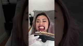 I Just Changed Teeth Whitening FOREVER [upl. by Arehahs]