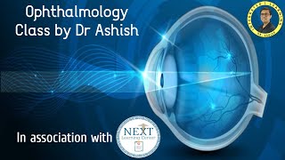 OPHTHALMOLOGY CLASS 4  Glaucoma and Retina [upl. by Hedelman496]