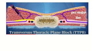 Maxillary nerve  Course branches and distribution Trigeminal nerve  Simplfied [upl. by Woods866]