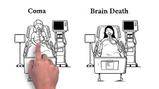 How is Brain Death Different than Coma [upl. by Ahab]