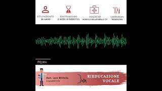 Noduli bilaterali alle corde vocali  Logopedia di 2 mesi [upl. by Salli]