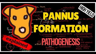 Rheumatology Mechanism of Pannus formation in Rheumatoid Arthritis [upl. by Valdemar567]