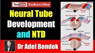 Neural Tube Development and Neural Tube Defects NTD Dr Adel Bondok [upl. by Enrev963]