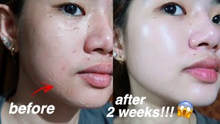 KOREAN SKIN IS REAL😱 I TRIED REJUVINATING SET FOR 2 WEEKS AND THIS IS WHAT HAPPENED [upl. by Negam]