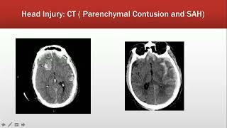 Emergency Radiology Course Session 1 [upl. by Thenna]