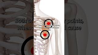 Pectoralis Minor Trigger Points [upl. by Kcuhc]