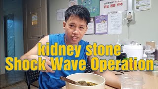 Shock wave or Laser Operation done for my small kidney Stone at left stomach here in South korea [upl. by Elocen]