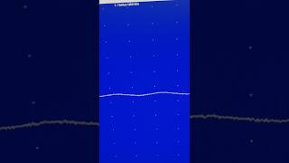 fibrillations potentials on EMG [upl. by Nosned]