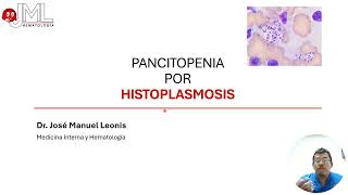 PANCITOPENIA  HISTOPLASMOSIS [upl. by Mayda]