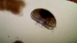 č˛ťĺ˝˘č™«ă®1ç¨® Ostracoda sp [upl. by Imelida573]