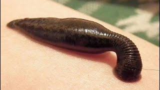 A time lapse video of leech sucking blood ayurveda navel ayurvedicmedicine leechtherapy hijama [upl. by Ennayhc]