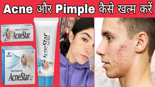 Acne aur Pimple kaise khatam kare  acne Pimple khatam kerne ka soap  face wash gel  Dr Sid [upl. by Carboni]