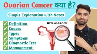 Ovarian Cancer in Hindi  Types Causes Symptoms And Treatment of Ovarian Cancer [upl. by Haldas]