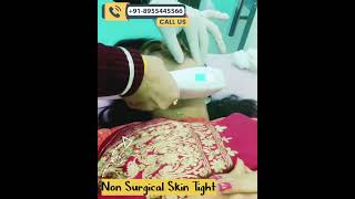 Revitalize Your Beauty HIFU Face Skin Tightening Treatment with Dr Deepesh Goyal [upl. by Sinnelg]