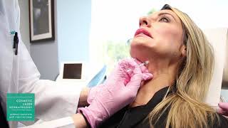 Platysmal Neck Band Treatment Botox Demonstration by Dr Monica Boen [upl. by Eiramesor]