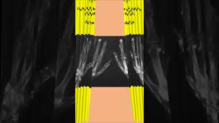 Made You Look RheumatologyArthritis Picture and Xray Quiz 3 [upl. by Plate]