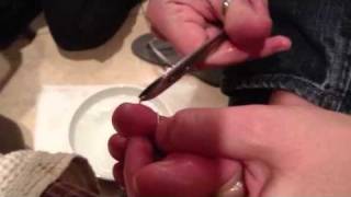 Removing Carines toe rings [upl. by Dillon197]