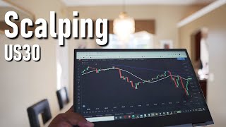 1 Min Scalping On US30  Fast Pips 📈 [upl. by Yroc852]