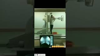 Barium swello radiologycareer radiographer neet radiology trending trendingshorts [upl. by Talbott321]