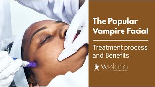 Benefits Of Popular Vampire Facial  Treatment Process PRP Microneedling For Skin Treatment Chennai [upl. by Ajak884]