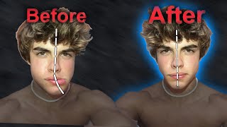 How To fix An Asymmetrical Face [upl. by Nagap]