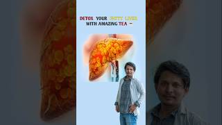 Detox Your Fatty Liver  Home Remedies For Fatty Liver  Liver Detox shorts fattyliver liverdetox [upl. by Ahserak]