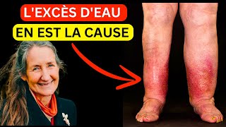 15 ans de jambes et de pieds enflés disparus en quelques minutes  La découverte de Barbara ONeill [upl. by Rasaec]