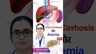 Liver cirrhosis or anemia shorts [upl. by Nitsirc290]