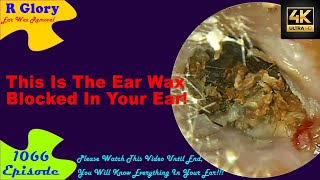 This Is The Ear Wax Blocked In Your Ear New Video Ear Wax Removal 1066 earwax earwaxremoval [upl. by Monte]