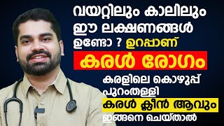 കരളിലെ കൊഴുപ്പ് പുറംതള്ളി കരൾ ക്ലീൻ ആവും ഇങ്ങനെ ചെയ്താൽ  Fatty Liver and Liver Disease Malayalam [upl. by Stoll49]