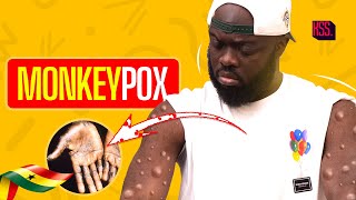 Monkeypox Outbreak A Conversation With Health Personnel About It [upl. by Artiek]