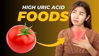 HIGH URIC ACID FOODS [upl. by Cassandre]