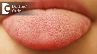 What causes small red patches on tongue  Dr Sana Taher [upl. by Smaj]