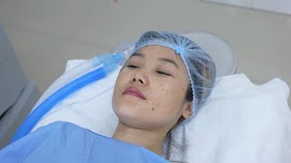 Girl goes under deep sleep before Anesthesia  Intubation Anesthesia [upl. by Nodanrb]