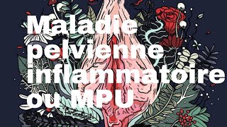 Maladie pelvienne inflammatoire ou MPU [upl. by Yeleen]