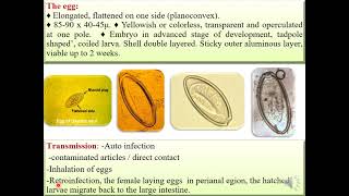 Family OxyuridaeOxyuris equi Entrobius vermecularis morphology life cycle الديدان الدبوسية [upl. by Arrol]