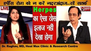 Herpes हर्पीस रोग का ऐसा ठोस इलाज नहीं देखा होगा  Dr Raghav  Heal Max Clinic  National khabar [upl. by Gittle]