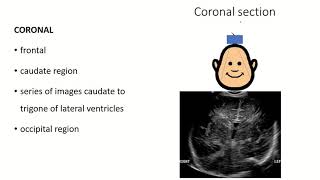 Fontanelle Insights A Comprehensive Anatomy Guide with Clinical Insights [upl. by Ayita]