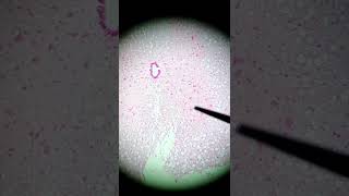 ¿Cómo se ve una motoneurona en microscopio  motoneurona  neurona histología histologia neurona [upl. by Premer]