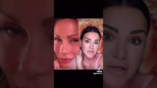 Jocelyn “cat woman” wildenstein botched plastic surgery story of her life amp how this happened part 1 [upl. by Aenad101]