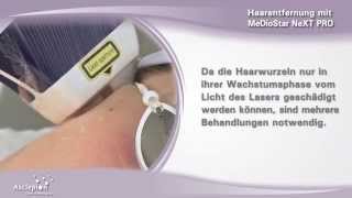 Haarentfernung mit dem Diodenlaser MeDioStar NeXT PRO von Asclepion [upl. by Danczyk228]