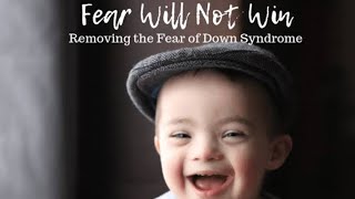 The changes in the child with Down Syndrome after therapy [upl. by Ahsuatal]