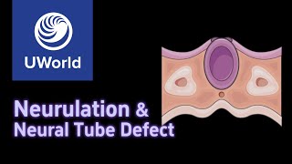 Neurulation amp Neural Tube Defects  Anencephaly Spina Bifida Occulta  USMLE Uworld Step 1 MBBS [upl. by Strickland]