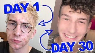 How I Cleared My Acne Scars in 30 Days [upl. by Beckerman]